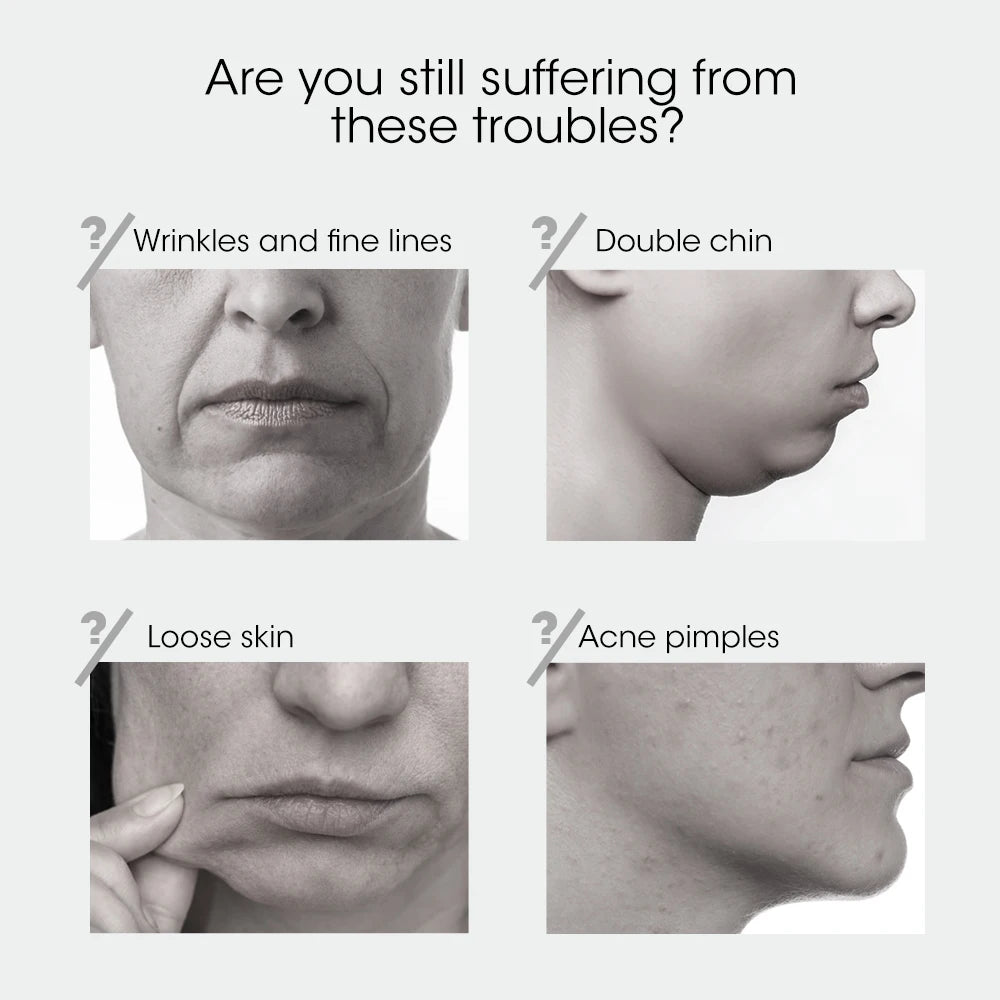 Advanced Face Lifting Device with Red Light Therapy for V-Shape Contouring, Double Chin Reduction, and Skin Rejuvenation