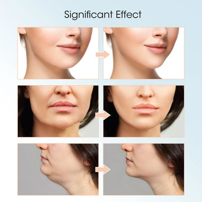 Advanced Face Lifting Device with Red Light Therapy for V-Shape Contouring, Double Chin Reduction, and Skin Rejuvenation